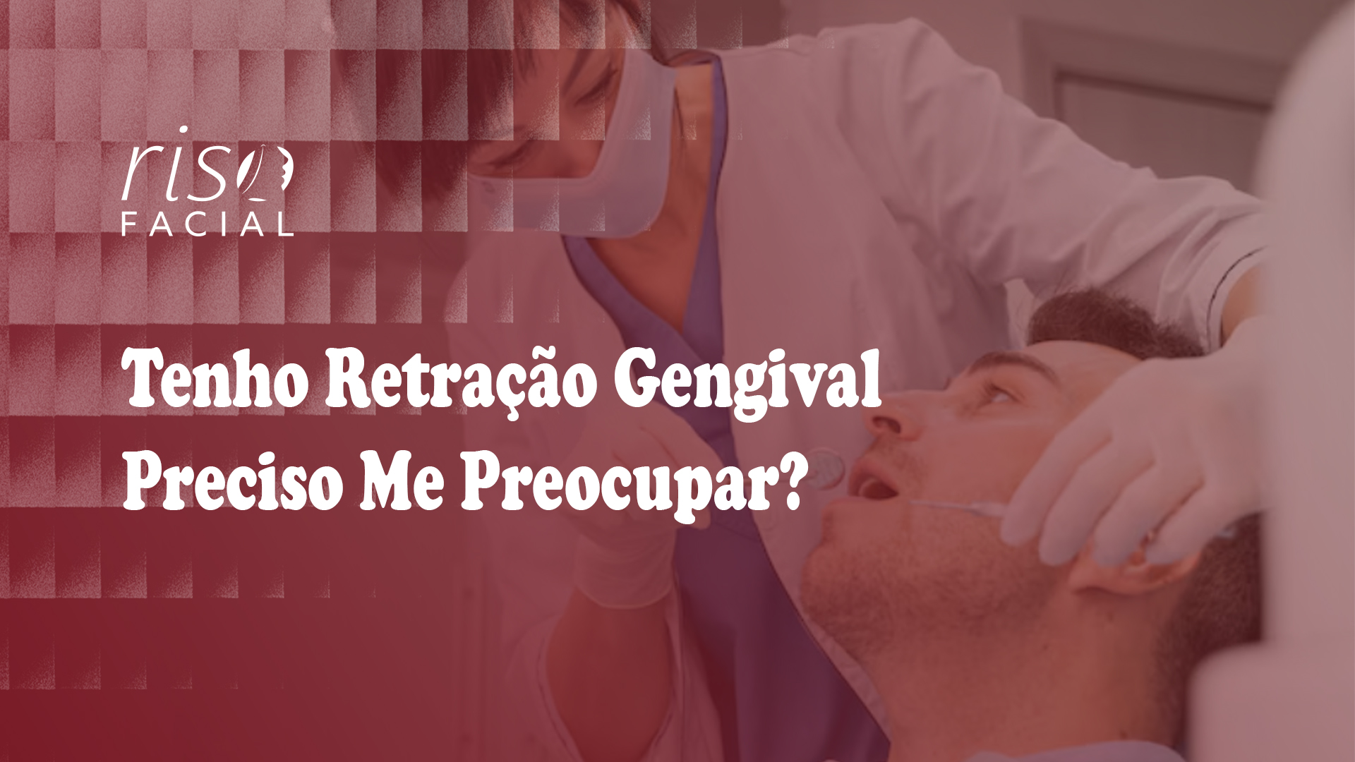 Imagem de capa: Retração Gengival